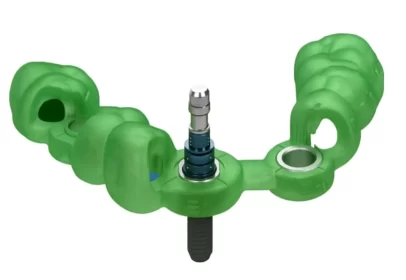 Guia Cirúrgico Dentário em 3D