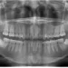 radiografia