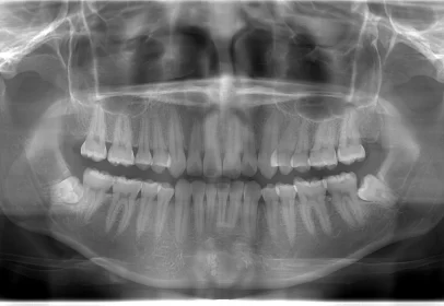 radiografia